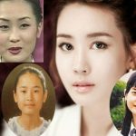 Sự thật hấp dẫn về giải phẫu thẩm mỹ