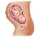 thực phẩm ngăn ngừa dị tật thai nhi