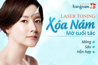 Trị nám da tại Kangnam