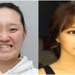 Bà mẹ 3 con khiến con khóc thét do quá khác biệt sau phẫu thuật thẩm mỹ