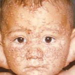 dịch bệnh trên thế giới