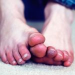 10-meo-tri-lanh-chan-hieu-qua-1