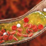 Top 10 thực phẩm giảm cholesterol phòng ngừa bệnh tim mạch